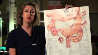 Surgeon Simply Explains Colon Cancer Surgery [upl. by Ayarahs236]