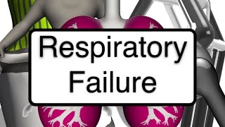 Nursing 101 Respiratory Failure [upl. by Ewer177]