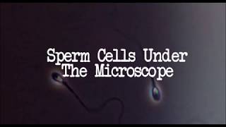 What Are Sperm Cells Sperm Under The Microscope [upl. by Natie]