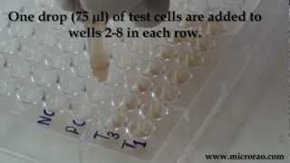 Treponema Pallidum Hemagglutination TPHA test for syphilis [upl. by Hewes]