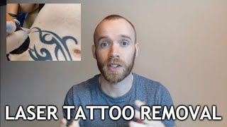 Laser Tattoo Removal  Sessions 13 Update [upl. by Tibold201]