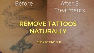 How To Remove Tattoos Naturally [upl. by Olegnaed]