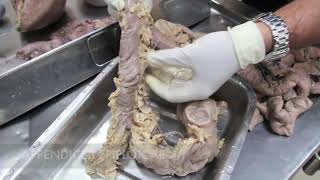 Anatomy Dissection of Large amp Small Intestine [upl. by Nnomae981]