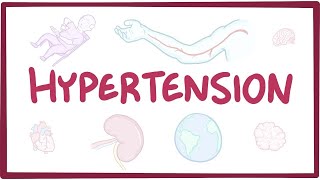 Hypertension Diagnosis and Treatment Options [upl. by Letnohs886]