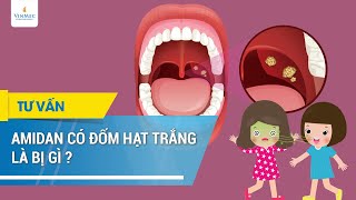 Amidan có đốm hạt trắng là bị gì [upl. by Kaine]