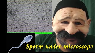 Sperm under microscope [upl. by Snook]