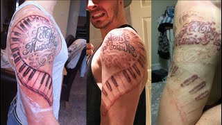 Laser Tattoo Removal  Full Experience [upl. by Oren875]