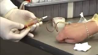 Venipuncture Procedure  Butterfly [upl. by Olva]