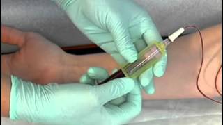 Sample Procedure  Venipuncture Butterfly Method [upl. by Ribak196]