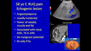 Liver Lesions [upl. by Wsan765]