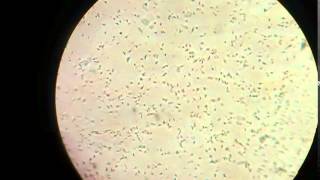 Sperm cells in microscope [upl. by Leiahtan]