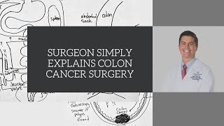 Warning Signs of Colorectal Cancer [upl. by Lalittah566]