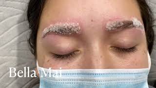 Eyebrow Salt and Saline Removal [upl. by Anitahs]