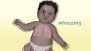 Common Pediatric Respiratory Problems by M Kleinman  OPENPediatrics [upl. by Willabella420]